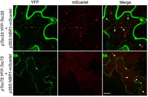 Figure 2：Co-localization of NBR1 and TOC proteins in the vacuoles