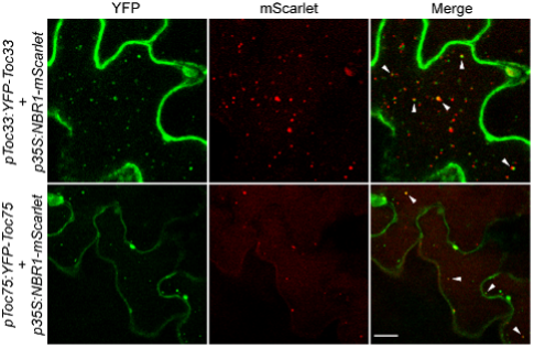 Figure 2 Figure 2:Co-localization of NBR1 and TOC proteins in the vacuoles